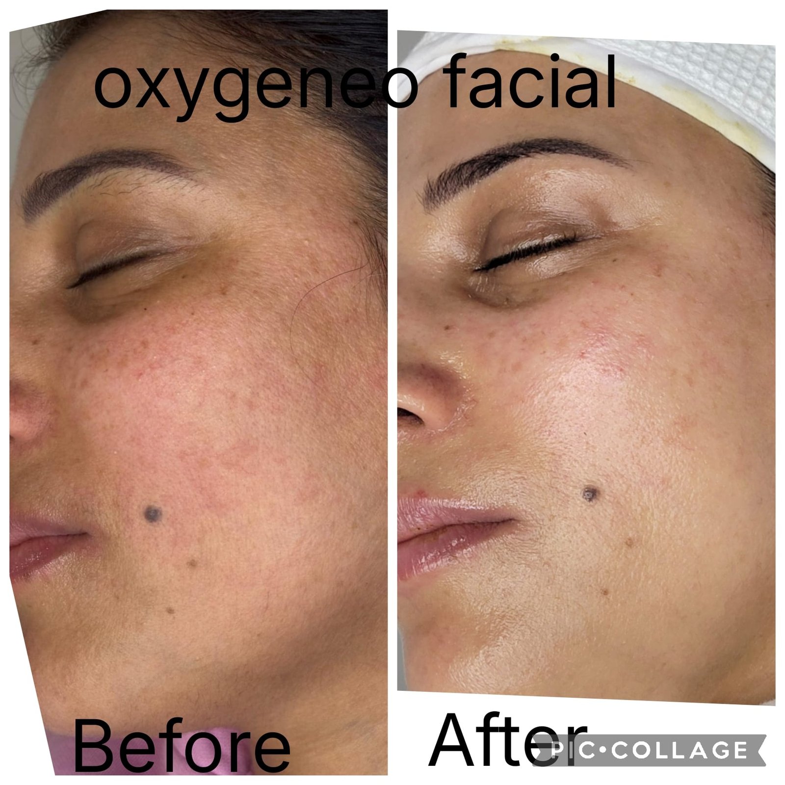 Before and After Treatment Results